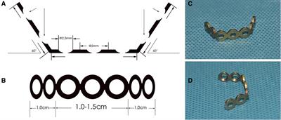 Initial clinical experiences of the muscle-preserving double door cervical laminoplasty with adjustable mini plates